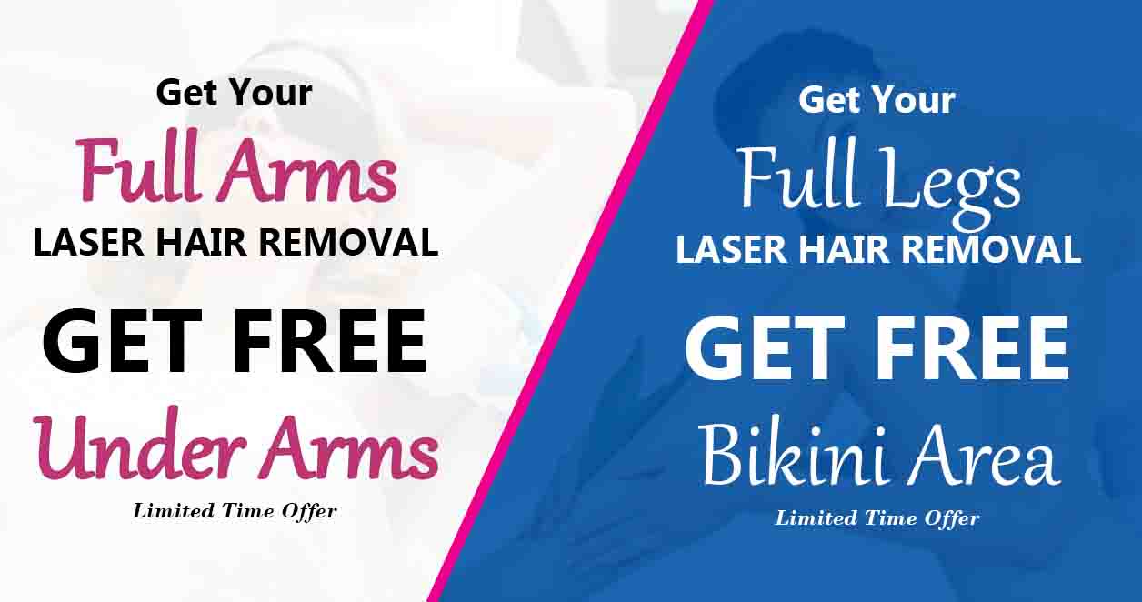 underarm laser hair removal offer